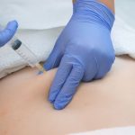 Emagrecimento: saiba como a ozonioterapia auxilia em tratamentos estéticos